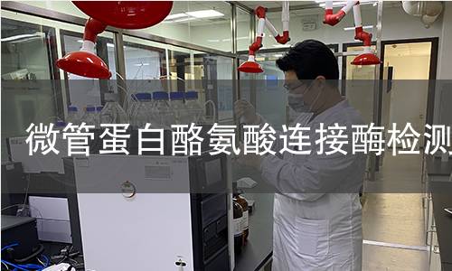 微管蛋白酪氨酸連接酶檢測 微管蛋白酪氨酸連接酶檢測